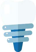 インプラントのイラスト