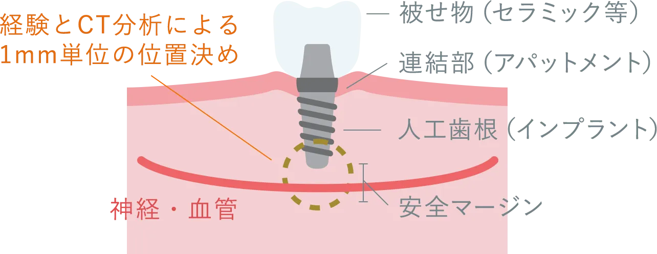 精密な診断と手術計画のイメージ